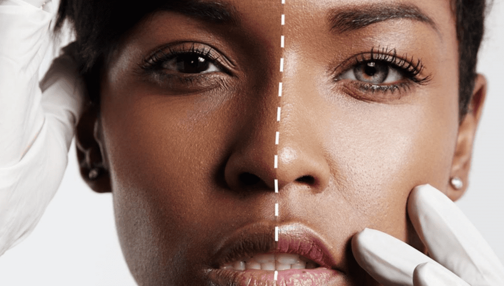 Rwanda is the Third African Nation to Take a Stand on Skin-Lightening Products